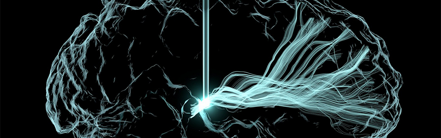 Illustration av hjärnstimulering och nervsignaler